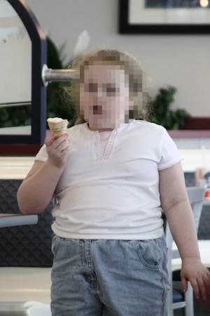 Obese Kid
